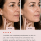 LumiSkin™ LED Facial Sculptor