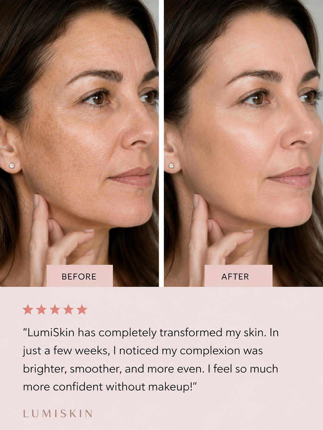 LumiSkin™ LED Facial Sculptor
